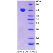 SDS-PAGE analysis of Mouse Chemerin Protein.