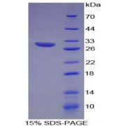 SDS-PAGE analysis of Rat C-X3-C Motif Chemokine Ligand 1 (CX3CL1) Protein.