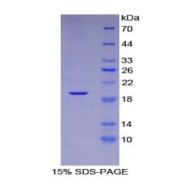 SDS-PAGE analysis of Human CXCL16 Protein.