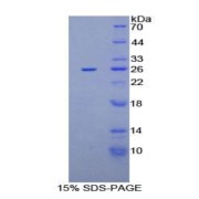 SDS-PAGE analysis of Rat CXCL16 Protein.