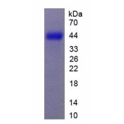 SDS-PAGE analysis of Rat CSPG5 Protein.