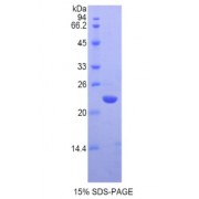 SDS-PAGE analysis of Human Chromobox Homolog 3 Protein.