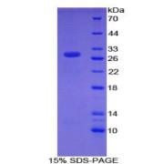 SDS-PAGE analysis of Mouse CHD3 Protein.