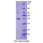 SDS-PAGE analysis of Mouse CNTF Protein.