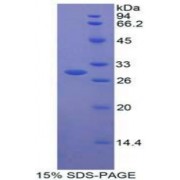 SDS-PAGE analysis of recombinant Human CNTFR Protein.