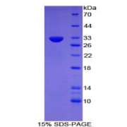 SDS-PAGE analysis of recombinant Mouse CD109 Protein.