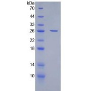 SDS-PAGE analysis of Human CD200 Protein.