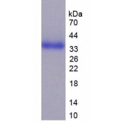 SDS-PAGE analysis of Human CD24 Protein.