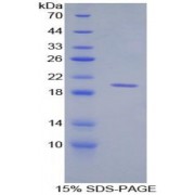 SDS-PAGE analysis of Human CD30L Protein.