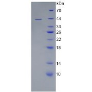 SDS-PAGE analysis of Human CD4 Protein.