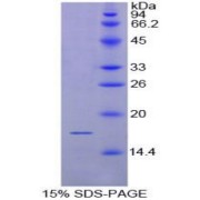 SDS-PAGE analysis of Rat CD72 Protein.