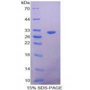 SDS-PAGE analysis of recombinant Dog Clusterin Protein.