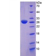 SDS-PAGE analysis of recombinant Human Clusterin Protein.