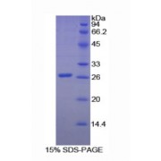SDS-PAGE analysis of recombinant Rat Clusterin Protein.
