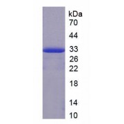 SDS-PAGE analysis of Rat Coagulation Factor II Protein.