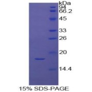 SDS-PAGE analysis of Cow Coagulation Factor IX Protein.