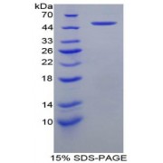 SDS-PAGE analysis of Rabbit Coagulation Factor IX Protein.
