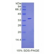 SDS-PAGE analysis of recombinant Mouse Coagulation Factor V Protein.