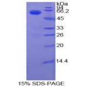 SDS-PAGE analysis of Cow Coagulation Factor VII Protein.
