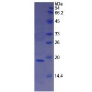 SDS-PAGE analysis of recombinant Human F8 Protein.