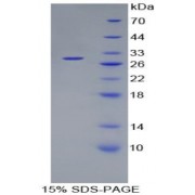 SDS-PAGE analysis of Human Coagulation Factor XI Protein.