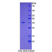 SDS-PAGE analysis of Human Cofilin 1, Non Muscle Protein.