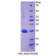 SDS-PAGE analysis of recombinant Mouse COL3A1 Protein.