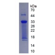 SDS-PAGE analysis of recombinant Human Collagen Type X Protein.