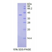 SDS-PAGE analysis of Human CSF2Rb Protein.