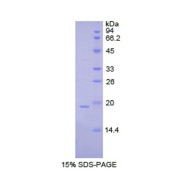 SDS-PAGE analysis of Human GCSF Protein.