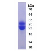 SDS-PAGE analysis of Rat GCSFR Protein.