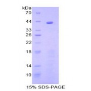 SDS-PAGE analysis of Human C8b Protein.