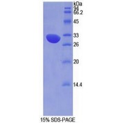 SDS-PAGE analysis of recombinant Mouse Complement Factor H Protein.