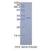 SDS-PAGE analysis of Rat Complement Factor H Protein.
