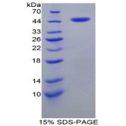 SDS-PAGE analysis of Human CRH Protein.