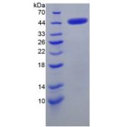 SDS-PAGE analysis of Mouse CRH Protein.