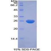 SDS-PAGE analysis of Human CFC1 Protein.