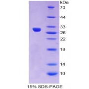 SDS-PAGE analysis of recombinant Human Crystallin Lambda 1 Protein.