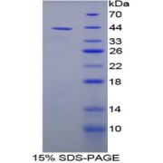 SDS-PAGE analysis of Rat CNP Protein.