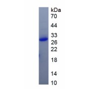 SDS-PAGE analysis of recombinant Mouse CD38 Protein.