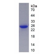 SDS-PAGE analysis of Mouse Cyclin Dependent Kinase 2 (CDK2) Protein.