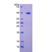 SDS-PAGE analysis of Human CDK2 Protein.