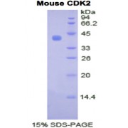 SDS-PAGE analysis of Mouse CDK2 Protein.