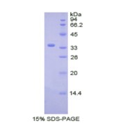 SDS-PAGE analysis of Human CDK4 Protein.