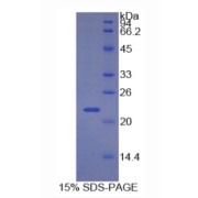 SDS-PAGE analysis of Human CDKN1A Protein.