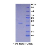 SDS-PAGE analysis of Human CDKN2A Protein.