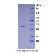 SDS-PAGE analysis of Mouse CDKN2A Protein.