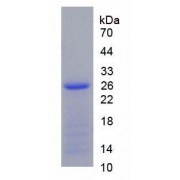 SDS-PAGE analysis of Human CTH Protein.