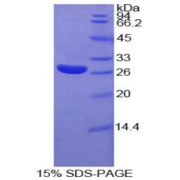 SDS-PAGE analysis of Human CYR61 Protein.