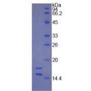 SDS-PAGE analysis of recombinant Human Cytochrome P450 1B1 Protein.